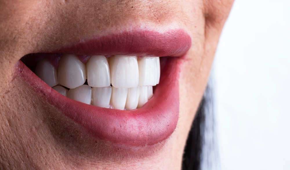 Everything You Need To Know About Full Mouth Rehabilitation